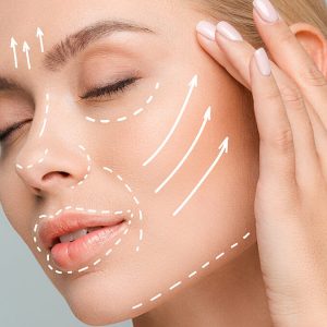 Lifting Facial Sin Cirugía (HIFU)